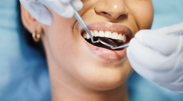 Best Urgent Dental Care for Toothache in Richnd, MO